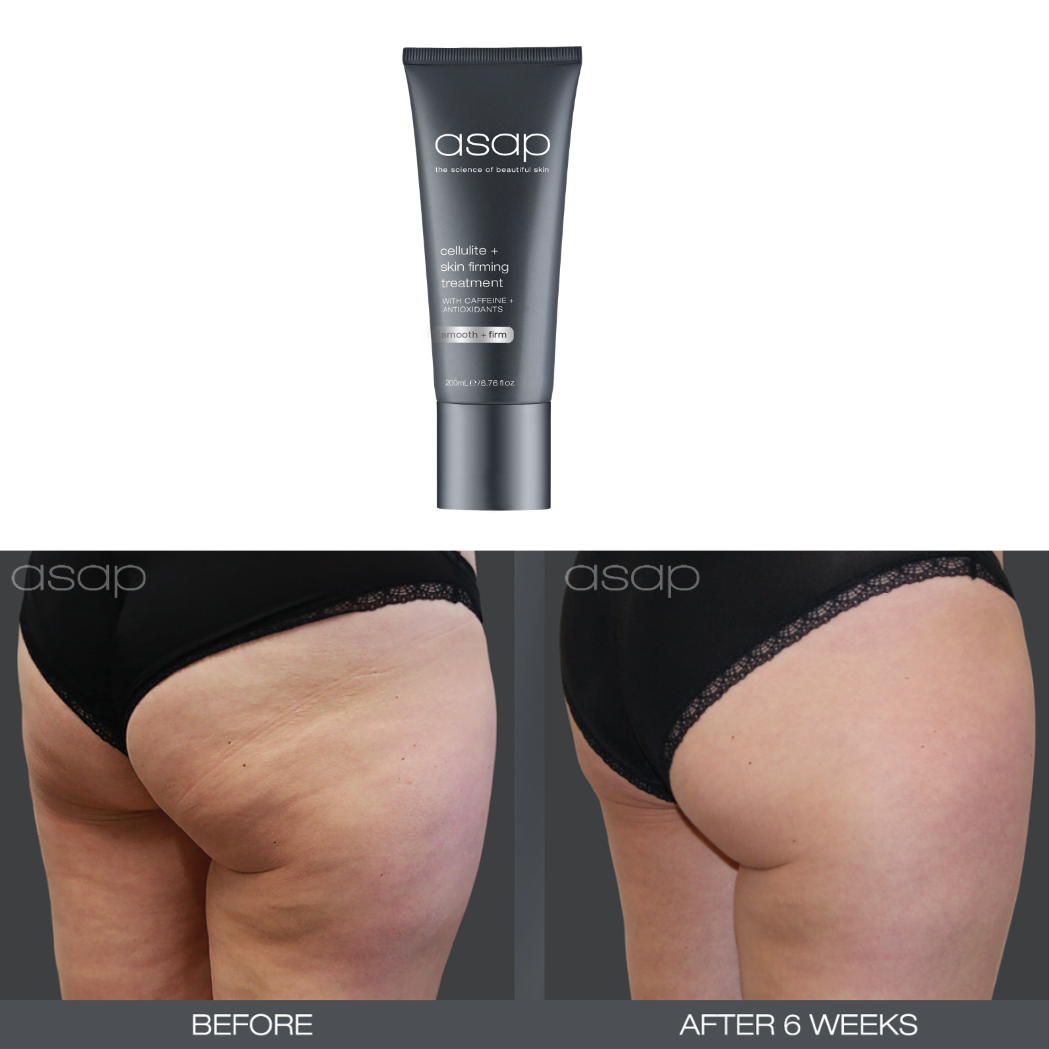 Cellulite + Skin Firming Treatment